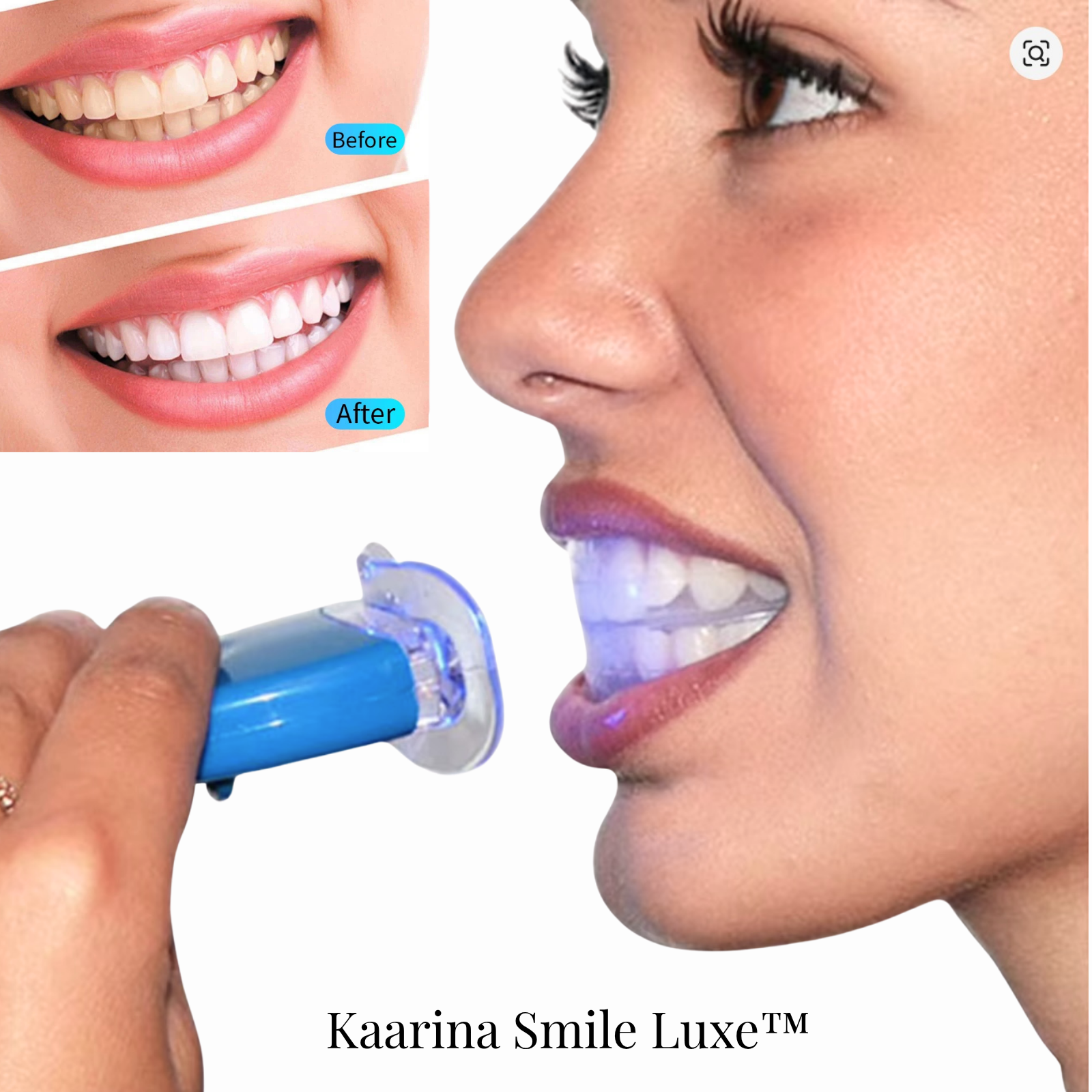 Kaarina Smile Luxe™