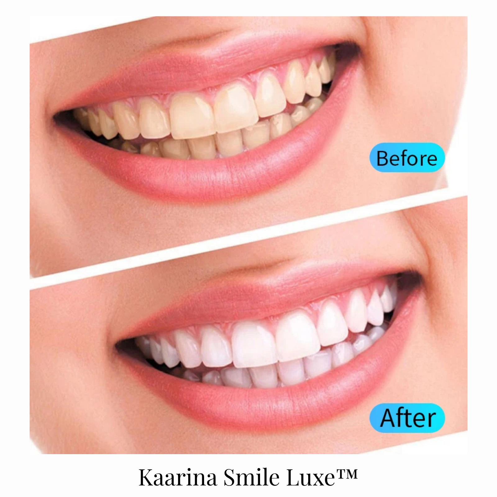 Kaarina Smile Luxe™